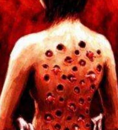 玉米男孩事件是真的吗?玉米男孩图片,密集恐惧症患者需谨慎_知识驿站 玉米男孩事件是真的吗?玉米男孩图片,密集恐惧症患者需谨慎