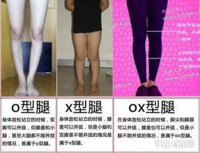 o型腿和x型腿真人图，o型腿和x型腿的体操矫正法