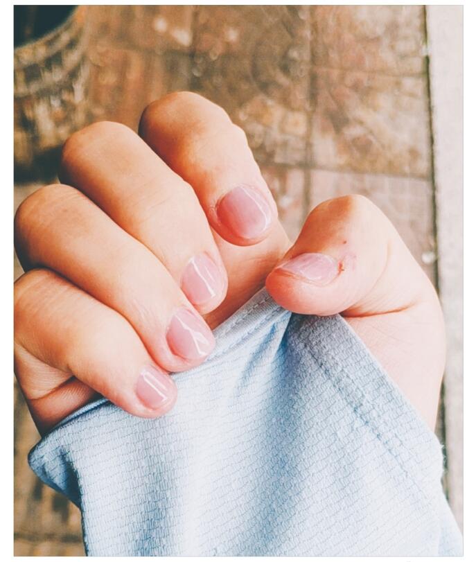 指甲上有竖纹是有病说法准确吗，不健康人的指甲图片